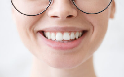 5 Cara Memutihkan Gigi Mudah: Perawatan & Makanan!